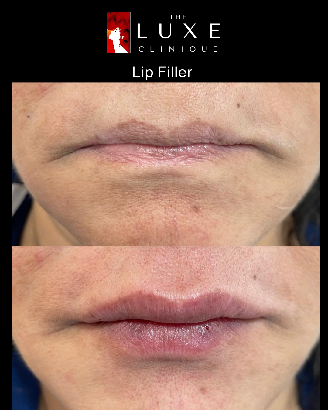 Facial Treatment 4
